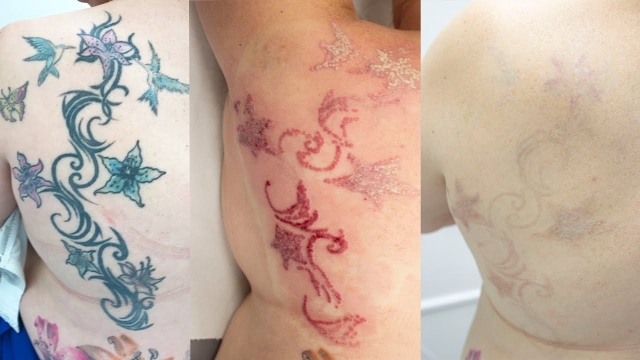 Wrecking Balm Tattoo Removal Cream Guide