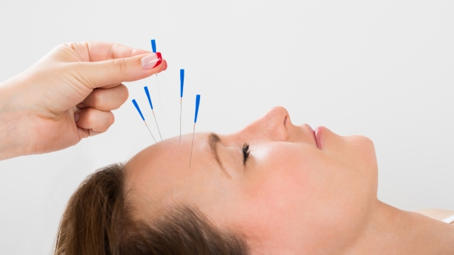 The Art of Acupuncture: Unleashing the Body’s Healing Powers